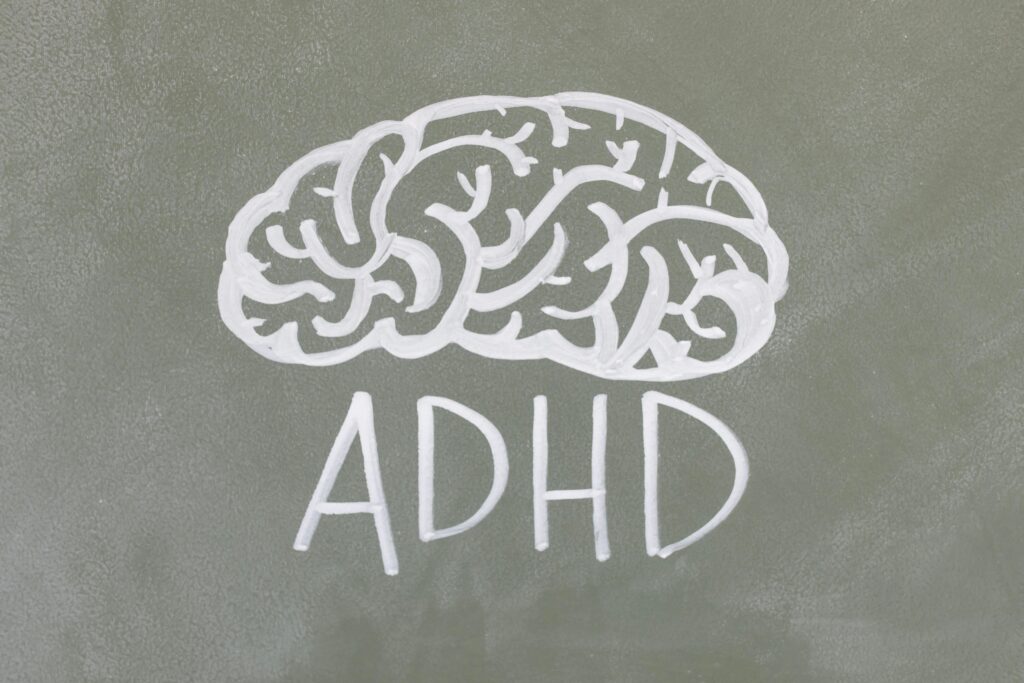 The word ADHD written under a drawing of a brain on a chalkboard.